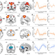 Image for article titled Why we have brain farts, and what scientists are doing to stop them
